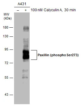 Paxillin (phospho Ser273) antibody